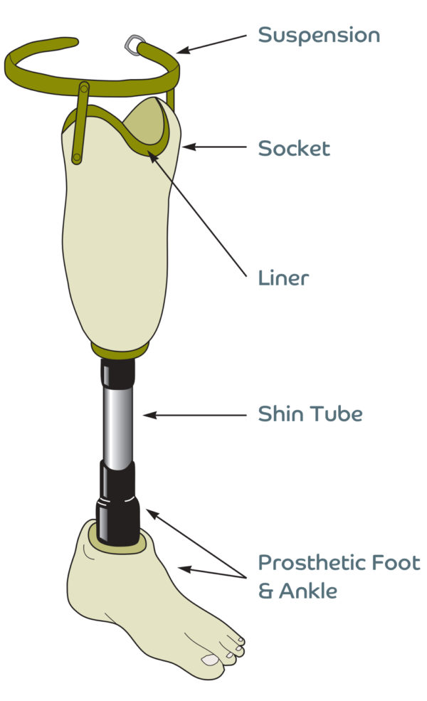 Below Knee Prosthesis - Endolite