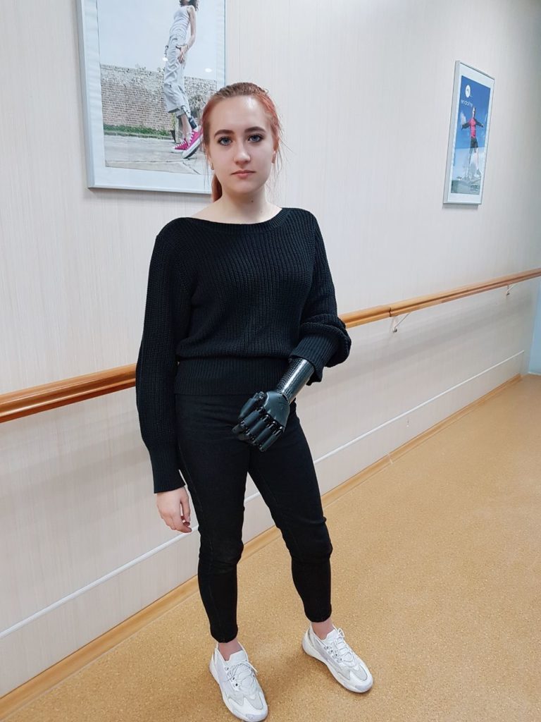 Студентка получила бионический протез кисти Vincent Systems